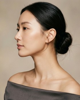 精准去双下巴手术效果展示